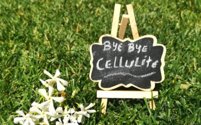 Cellulite Naturopatia